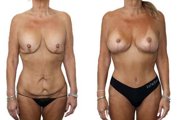 Cambio de imagen para mamás